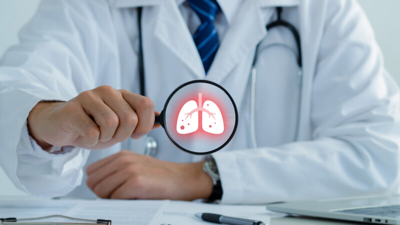 Asthma lung doctor